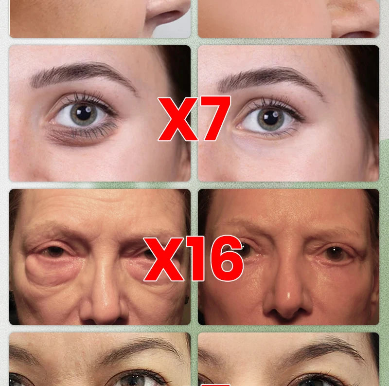 M&T Wear – 3 Days to Look 20 Years Younger Eye Cream | Anti-Aging, Dark Circle & Puffiness Repair Formula