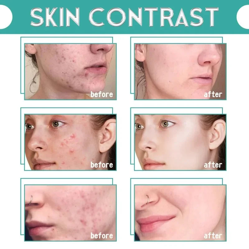 M&T Wear - Retinol & Vitamin Complex Anti-Aging Serum (30ml)