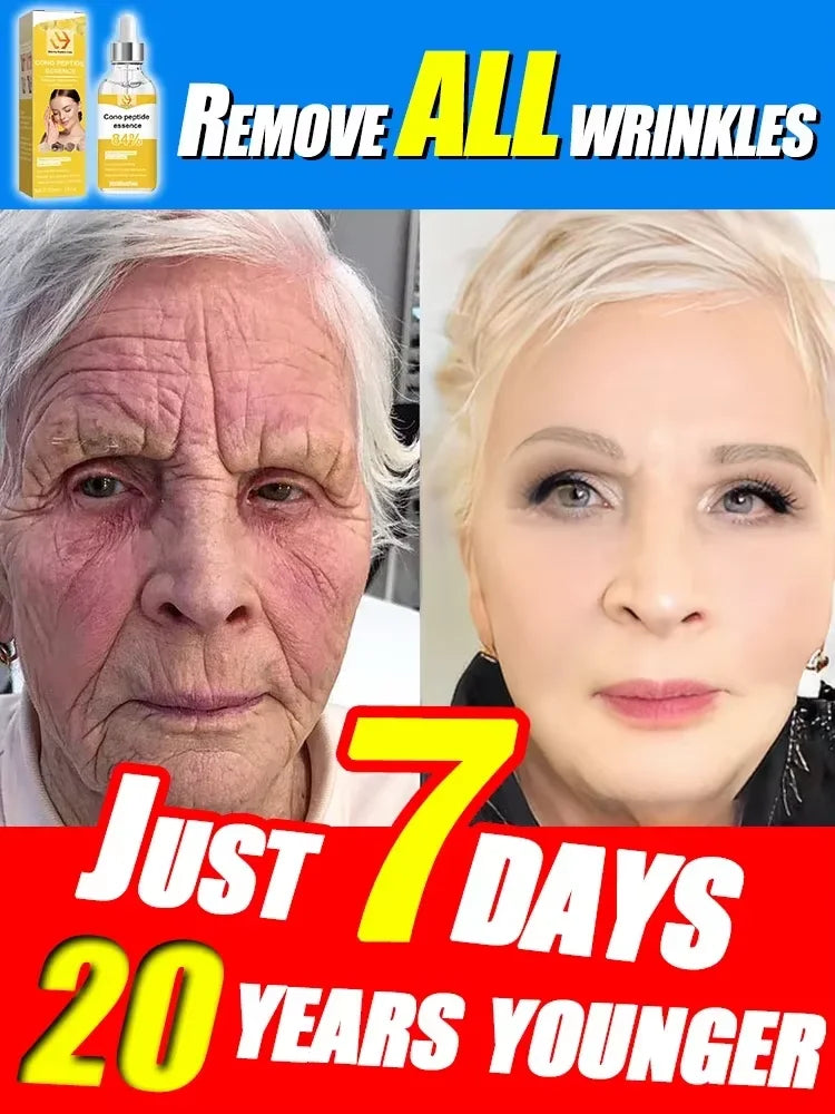 M&T Wear - Age Rewind Anti-Wrinkle Cream | Look Up to 20 Years Younger