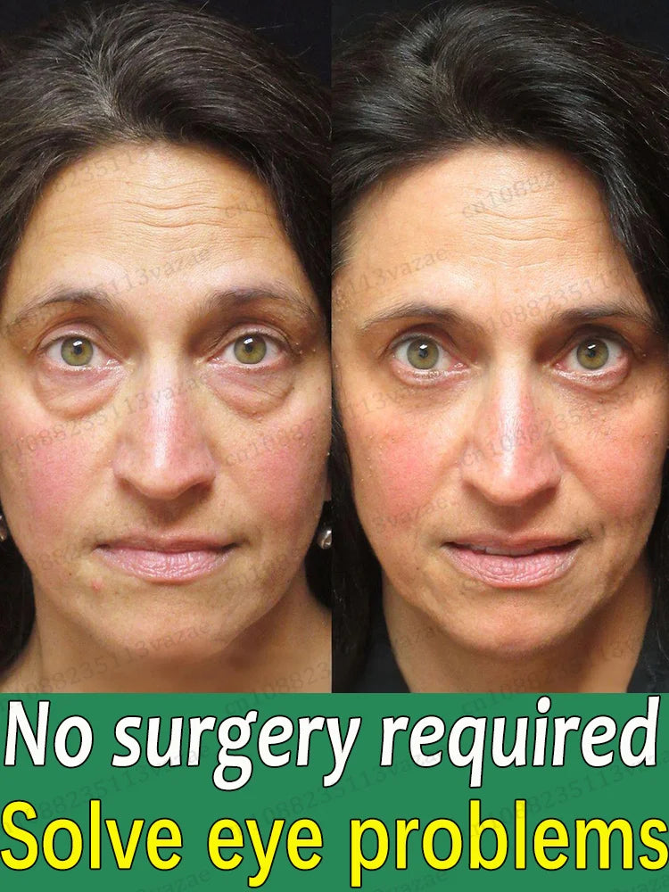 M&T Wear – 3 Days to Look 20 Years Younger Eye Cream | Anti-Aging, Dark Circle & Puffiness Repair Formula