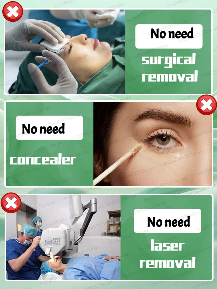 M&T Wear – 3 Days to Look 20 Years Younger Eye Cream | Anti-Aging, Dark Circle & Puffiness Repair Formula