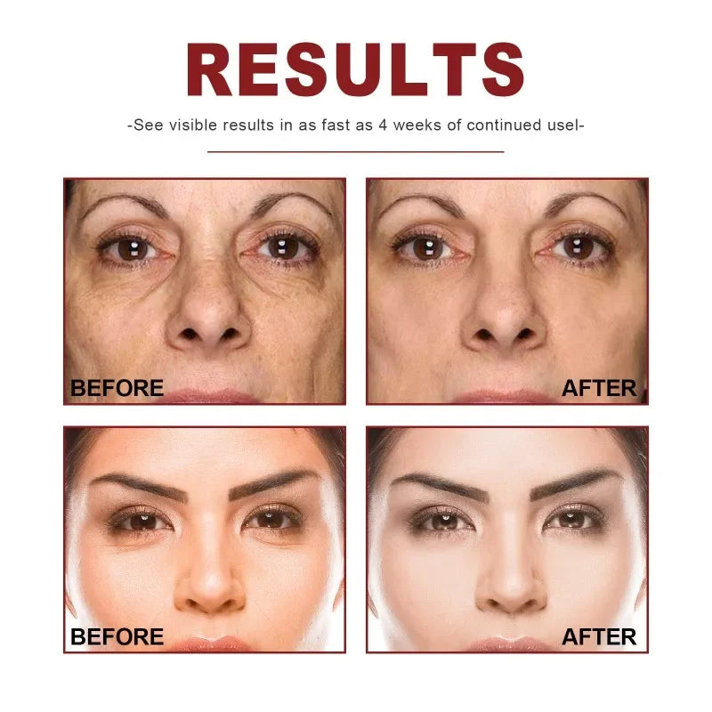 M&T Wear - Retinol & Vitamin Complex Anti-Aging Serum (30ml)