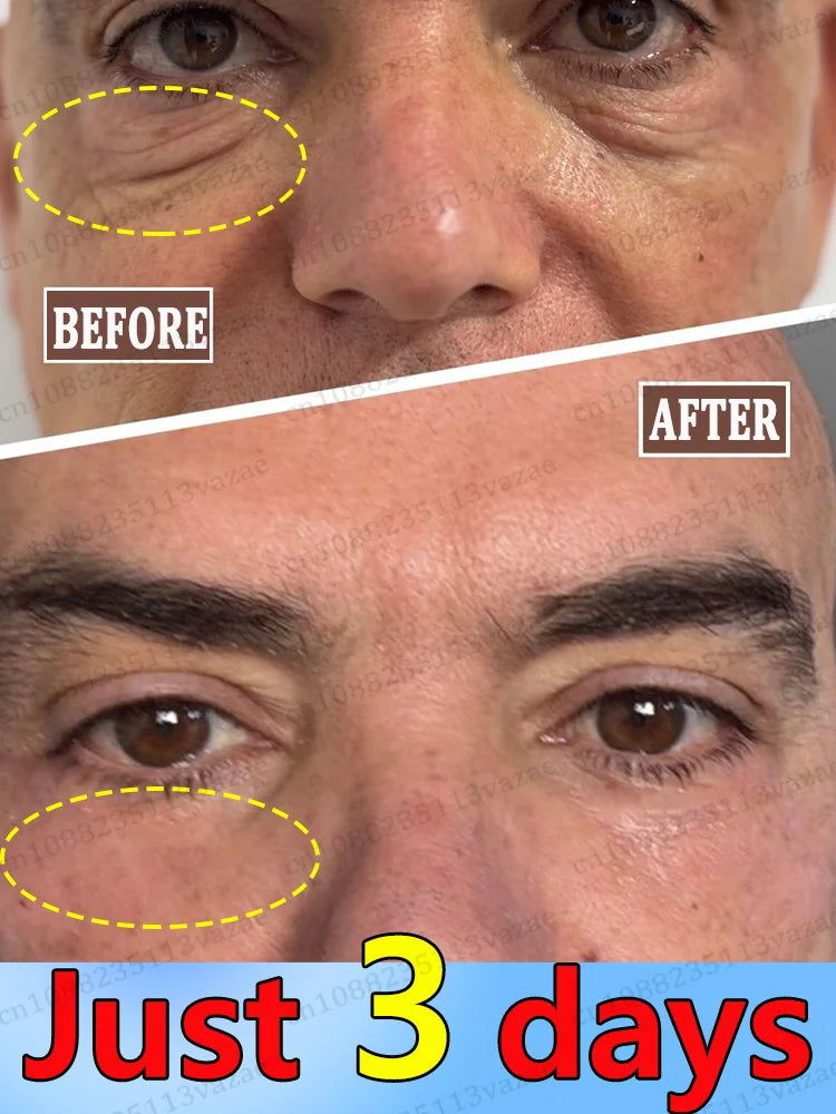 M&T Wear – 3 Days to Look 20 Years Younger Eye Cream | Anti-Aging, Dark Circle & Puffiness Repair Formula