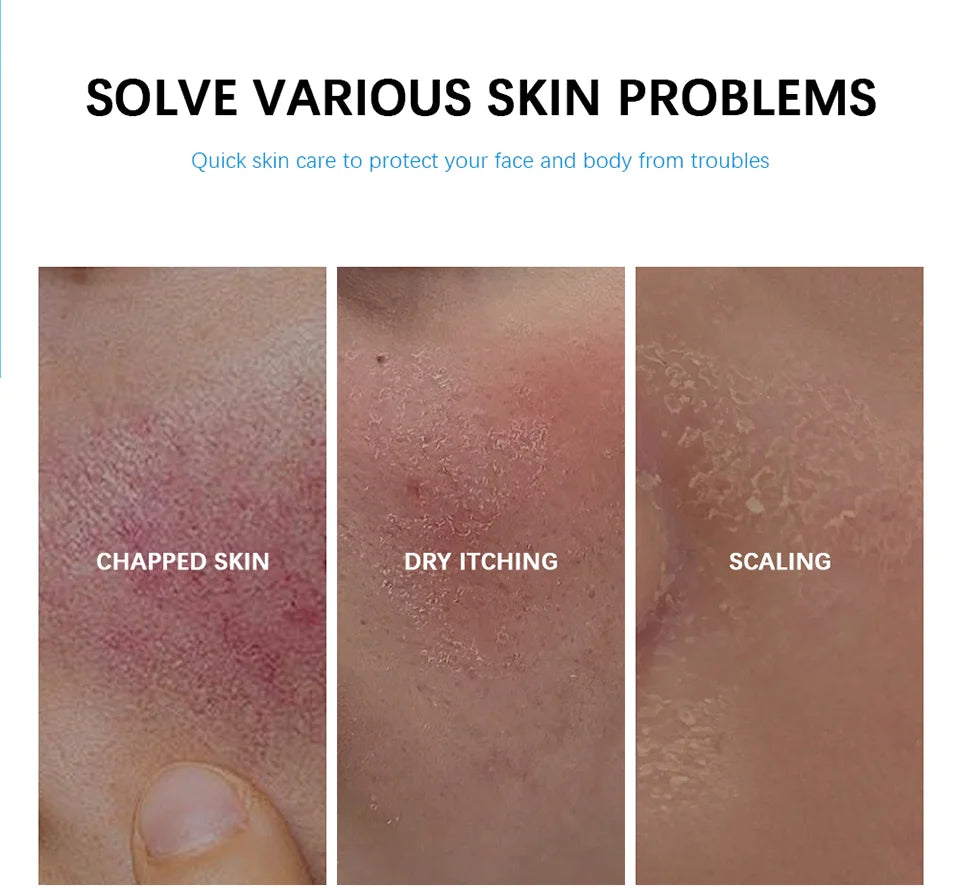 M&T Wear - Soothing Multi-Purpose Hydrating Cream | Deep Moisture & Skin Repair