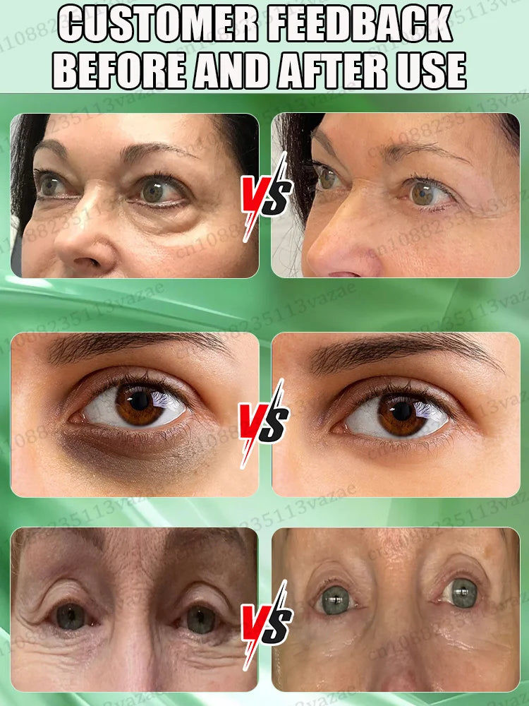 M&T Wear – 3 Days to Look 20 Years Younger Eye Cream | Anti-Aging, Dark Circle & Puffiness Repair Formula